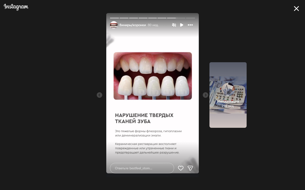 Циркониевые коронки — Bestfeel Dental Clinic