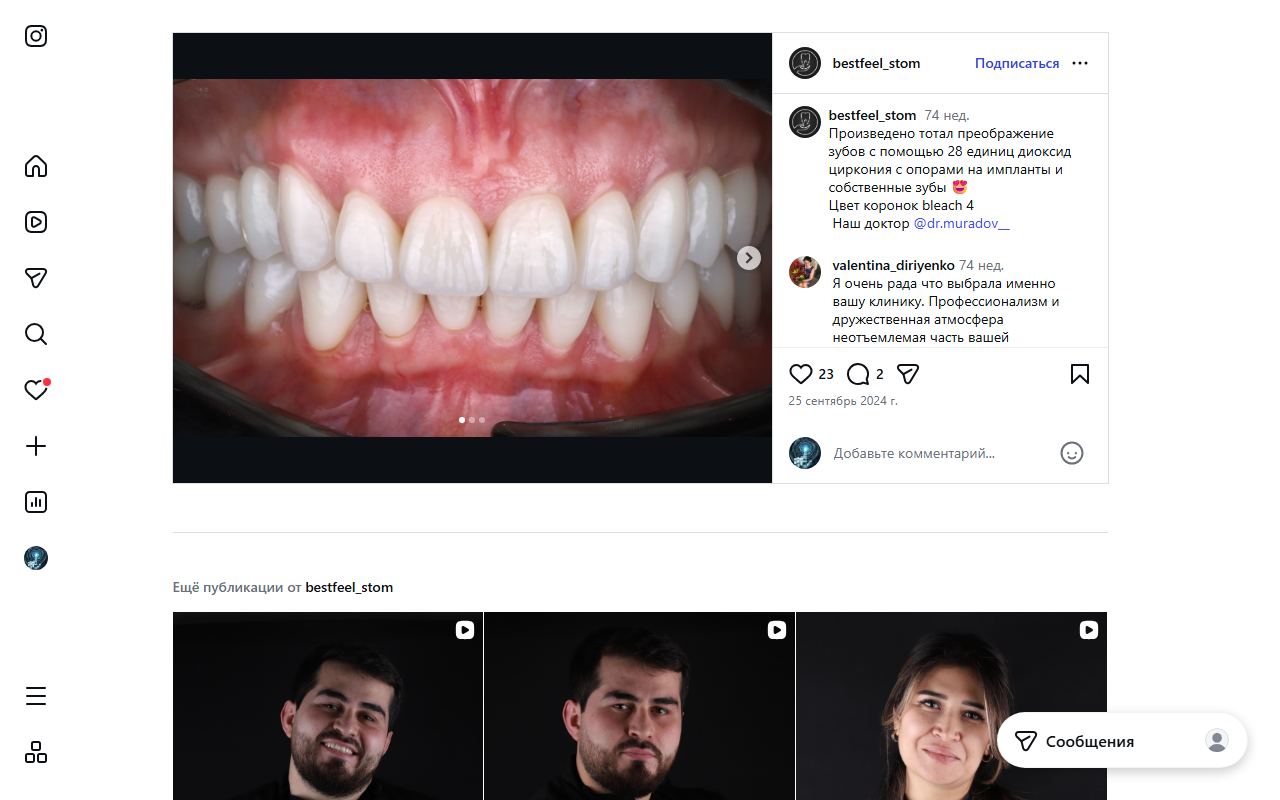 28 коронок диоксида циркония — тотальное преображение